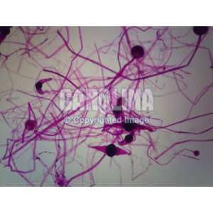 Rhizopus Conjugation, w.m. Microscope Slide:  Industrial 