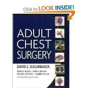 Adult Chest Surgery [Hardcover]: David Sugarbaker: Books