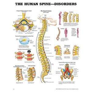 Anatomical Chart Company Human Spine Disorders Chart  