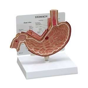  Stomach Anatomy Model w/ Patient Education Card 