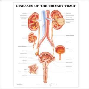  Diseases of the Urinary Tract Anatomical Chart 20 X 26 